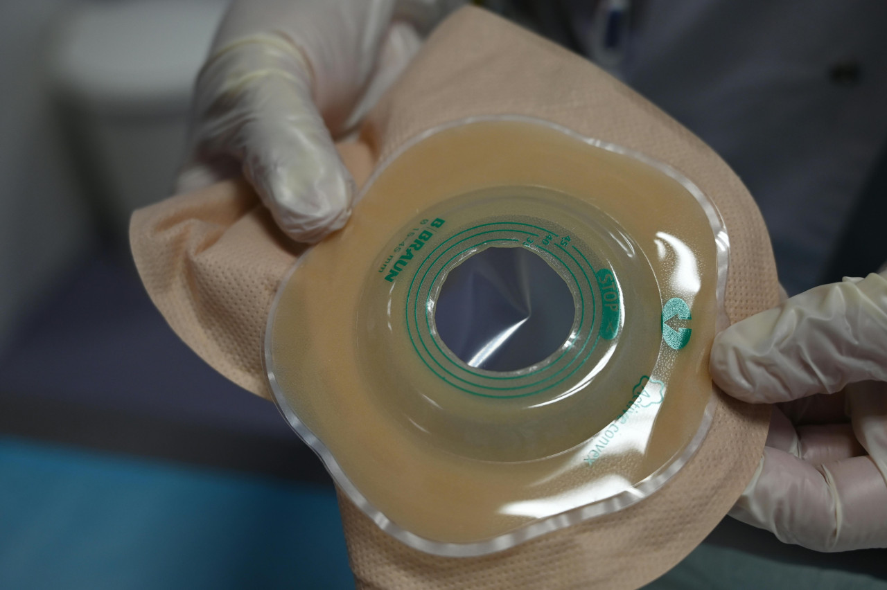 Gestione/formazione urostomia e colonstomia