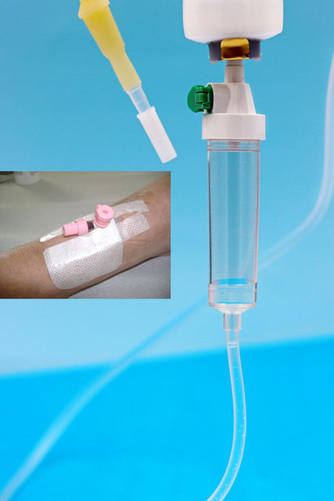 Collocazione CVP e terapia infusionale