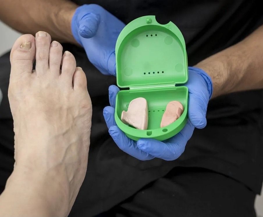 Ortesi In Silicone: Ortoplastia
